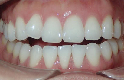 Dental Specialists of New York P.C.