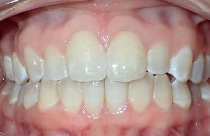 Dental Specialists of New York P.C.