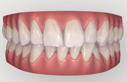 Dental Specialists of New York P.C.