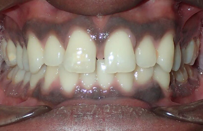 Dental Specialists of New York P.C.