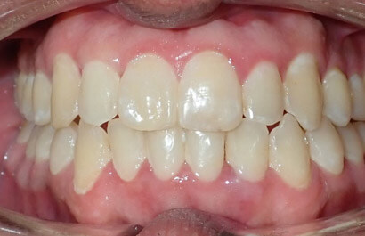 Dental Specialists of New York P.C.