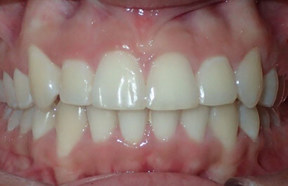 Dental Specialists of New York P.C.